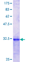 CETN1 Protein - 12.5% SDS-PAGE Stained with Coomassie Blue.