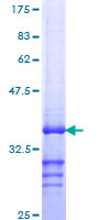 CETN2 / Centrin 2 Protein - 12.5% SDS-PAGE Stained with Coomassie Blue.