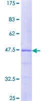 CETN3 Protein - 12.5% SDS-PAGE of human CETN3 stained with Coomassie Blue