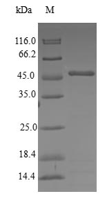 CETN3 Protein - (Tris-Glycine gel) Discontinuous SDS-PAGE (reduced) with 5% enrichment gel and 15% separation gel.