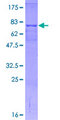 CETP Protein - 12.5% SDS-PAGE of human CETP stained with Coomassie Blue