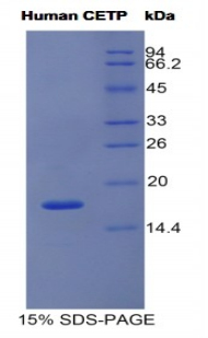 CETP Protein - Recombinant Cholesteryl Ester Transfer Protein By SDS-PAGE