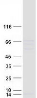 CETP Protein - Purified recombinant protein CETP was analyzed by SDS-PAGE gel and Coomassie Blue Staining