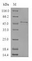 CFAP20 / GTL3 Protein - (Tris-Glycine gel) Discontinuous SDS-PAGE (reduced) with 5% enrichment gel and 15% separation gel.