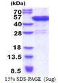 CFAP36 / CCDC104 Protein