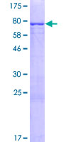 CFAP53 / CCDC11 Protein - 12.5% SDS-PAGE of human CCDC11 stained with Coomassie Blue
