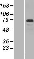 CFAP57 / WDR65 Protein - Western validation with an anti-DDK antibody * L: Control HEK293 lysate R: Over-expression lysate