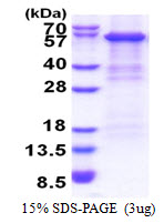 CFB / Complement Factor B Protein