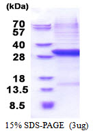 CFB / Complement Factor B Protein