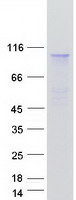 CFB / Complement Factor B Protein - Purified recombinant protein CFB was analyzed by SDS-PAGE gel and Coomassie Blue Staining