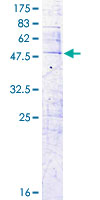 CFC1 Protein - 12.5% SDS-PAGE of human CFC1 stained with Coomassie Blue