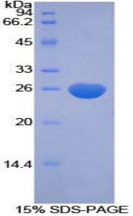 CFC1 Protein - Recombinant Cripto, FRL1, Cryptic Family 1 By SDS-PAGE