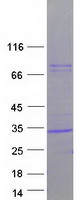 CFD / Factor D / Adipsin Protein - Purified recombinant protein CFD was analyzed by SDS-PAGE gel and Coomassie Blue Staining