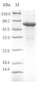 CFDP1 Protein - (Tris-Glycine gel) Discontinuous SDS-PAGE (reduced) with 5% enrichment gel and 15% separation gel.