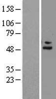 CFH / Complement Factor H Protein - Western validation with an anti-DDK antibody * L: Control HEK293 lysate R: Over-expression lysate