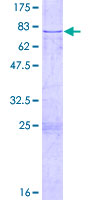 CFH / Complement Factor H Protein - 12.5% SDS-PAGE of human CFH stained with Coomassie Blue