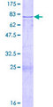 CFH / Complement Factor H Protein - 12.5% SDS-PAGE of human CFH stained with Coomassie Blue