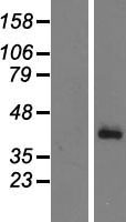 CFHR1 Protein - Western validation with an anti-DDK antibody * L: Control HEK293 lysate R: Over-expression lysate