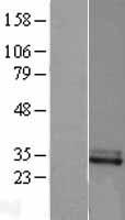 CFHR2 Protein - Western validation with an anti-DDK antibody * L: Control HEK293 lysate R: Over-expression lysate