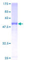 CFHR2 Protein - 12.5% SDS-PAGE of human CFHL2 stained with Coomassie Blue