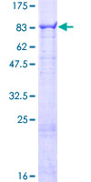 CFHR5 Protein - 12.5% SDS-PAGE of human CFHR5 stained with Coomassie Blue