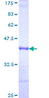 CFI / Complement Factor I Protein - 12.5% SDS-PAGE Stained with Coomassie Blue.