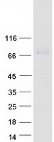 CFI / Complement Factor I Protein - Purified recombinant protein CFI was analyzed by SDS-PAGE gel and Coomassie Blue Staining