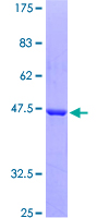 CFL1 / Cofilin Protein - 12.5% SDS-PAGE of human CFL1 stained with Coomassie Blue