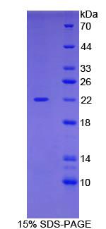 CFL1 / Cofilin Protein - Recombinant Cofilin 1, Non Muscle By SDS-PAGE