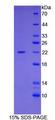 CFL1 / Cofilin Protein - Recombinant Cofilin 1, Non Muscle By SDS-PAGE