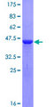 CFL2 / Cofilin 2 Protein - 12.5% SDS-PAGE of human CFL2 stained with Coomassie Blue