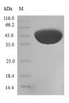 CFL2 / Cofilin 2 Protein - (Tris-Glycine gel) Discontinuous SDS-PAGE (reduced) with 5% enrichment gel and 15% separation gel.