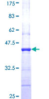 CFL2 / Cofilin 2 Protein - 12.5% SDS-PAGE Stained with Coomassie Blue.