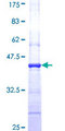 CFL2 / Cofilin 2 Protein - 12.5% SDS-PAGE Stained with Coomassie Blue.