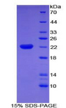 CFL2 / Cofilin 2 Protein - Recombinant Cofilin 2, Muscle By SDS-PAGE