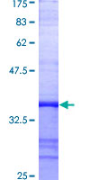 CFLAR / FLIP Protein - 12.5% SDS-PAGE Stained with Coomassie Blue.
