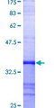 CFLAR / FLIP Protein - 12.5% SDS-PAGE Stained with Coomassie Blue.