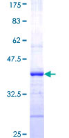 CFTR Protein - 12.5% SDS-PAGE Stained with Coomassie Blue.