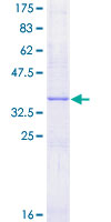 CGA / hCG Alpha Protein - 12.5% SDS-PAGE of human CGA stained with Coomassie Blue