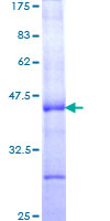 CGA / hCG Alpha Protein - 12.5% SDS-PAGE Stained with Coomassie Blue.