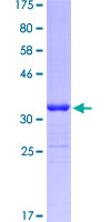 CGB / hCG Beta Protein - 12.5% SDS-PAGE Stained with Coomassie Blue.