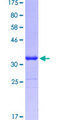 CGB / hCG Beta Protein - 12.5% SDS-PAGE Stained with Coomassie Blue.