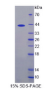 CGB / hCG Beta Protein - Recombinant Chorionic Gonadotropin Beta Polypeptide 1 (CGb1) by SDS-PAGE