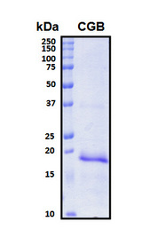 CGB / hCG Beta Protein - SDS-PAGE under reducing conditions and visualized by Coomassie blue staining