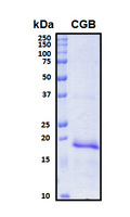 CGB / hCG Beta Protein - SDS-PAGE under reducing conditions and visualized by Coomassie blue staining