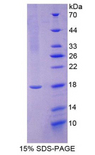 CGB / hCG Beta Protein - Recombinant Chorionic Gonadotropin Beta Polypeptide By SDS-PAGE