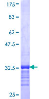 CGB2 Protein - 12.5% SDS-PAGE Stained with Coomassie Blue.