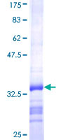 CGB5 Protein - 12.5% SDS-PAGE Stained with Coomassie Blue.