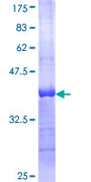 CGB7 Protein - 12.5% SDS-PAGE Stained with Coomassie Blue.