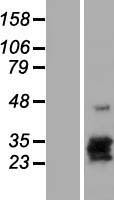 CGB8 Protein - Western validation with an anti-DDK antibody * L: Control HEK293 lysate R: Over-expression lysate
